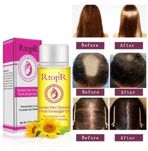 Fast Powerful Hair Growth Products Essential Oil Liquid Treatment Preventing Hair Loss Hair Care 20ml - Zambeel