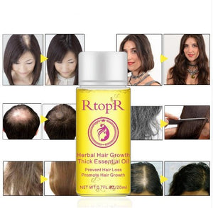 Fast Powerful Hair Growth Products Essential Oil Liquid Treatment Preventing Hair Loss Hair Care 20ml - Zambeel