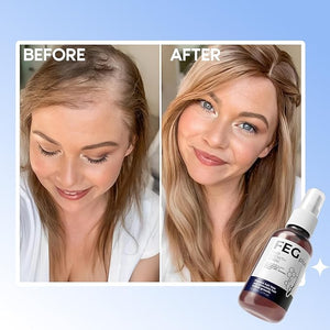 FEG Plus Hair Growth Spray (Original) - Zambeel