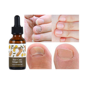 Guanjing - Nail Care Ginger Oil - Zambeel