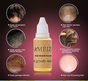 Hair Growth anti Hair Loss Liquid 20ml - Zambeel