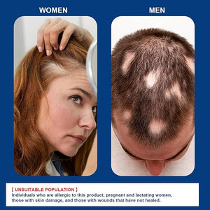 Hair Growth Cream (20g) - Zambeel