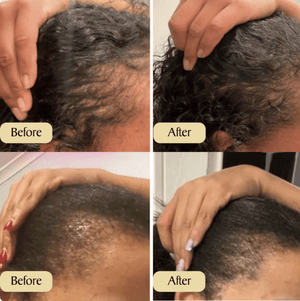 Hair Growth Oil - Zambeel