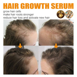 Hair Growth Repair Care Essential Oil - Zambeel
