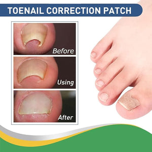 Hanel - Pain Relief Patch (Original) - Zambeel