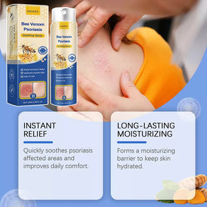 HOUKEA - Bee Venom Psoriasis Soothing Spray (Original) - Zambeel