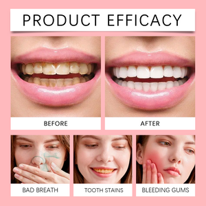 SP-8 Probiotic Dental Care Toothpaste