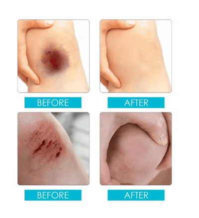 Jaysuing - Liquid Wound Dressing (Original) - Zambeel
