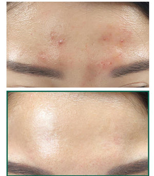 Keratin Care Soothing Repair Serum - Zambeel