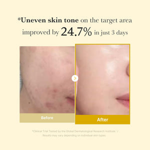 Kojic Acid Turmeric Night Wrapping Mask - Zambeel