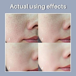 LANBENA - Pore Solution Serum (Original) - Zambeel