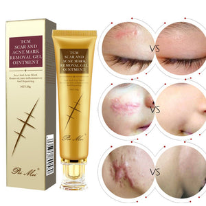 Light Scar Cream Scar Fine Grain Desalination Skin Care Products - Zambeel