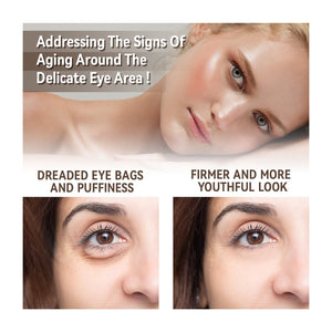 Moisturizing Eye Skin Care - Zambeel