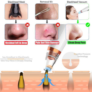 Multi - Functional Blackhead Remover - Zambeel