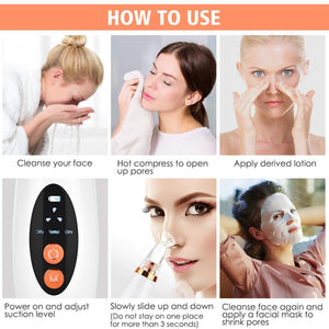 Multi - Functional Blackhead Remover - Zambeel