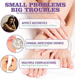 Nail Fungus Spray - Zambeel