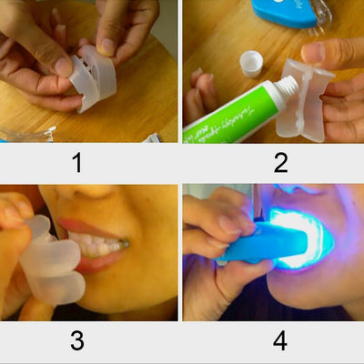 Oral Gel Teeth Tooth Whitening Whitener Dental Bleaching LED - Zambeel