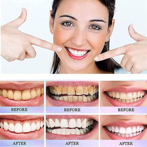 Oralhoe - Nicotinamide Dazzle White Toothpaste (Original) - Zambeel