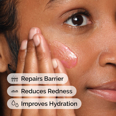 The Ordinary - Soothing & Barrier Support Serum
