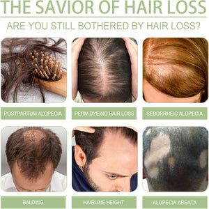 OUHOE - Adivasi Hair Oil (Original) - Zambeel