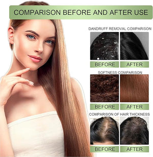 OUHOE - Adivasi Hair Oil (Original) - Zambeel