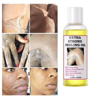 Peeling Oil (110ml) - Zambeel