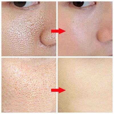Pore Refining Serum - Zambeel