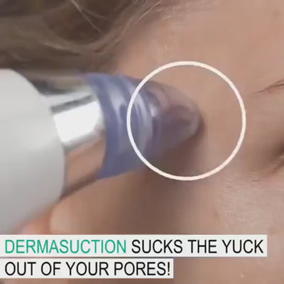 Blackhead Remover