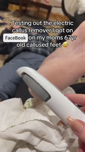 Electric Pedicure Foot File Callus Remover