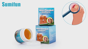 Sumifun - مرهم فطريات الأظافر