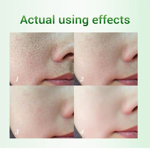 Salicylic Acid Pore Refinement Cream Lotion Skin Rejuvenation Cream Skin Care Products - Zambeel