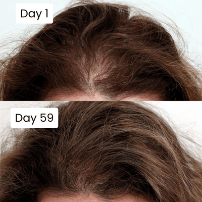 Scalp Hair Growth Serum - Zambeel