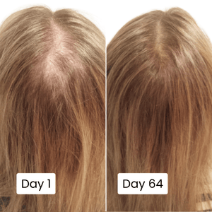 Scalp Hair Growth Serum - Zambeel