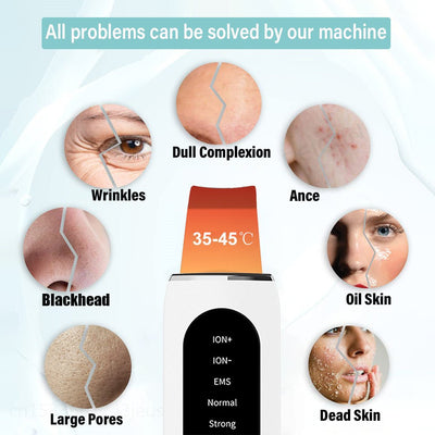 Shovel Skin Blackhead Ultrasonic Beauty Microcurrent Color Light - Zambeel
