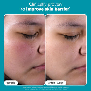 Skin Perfecting 2% BHA Liquid Exfoliant (Original) - Zambeel