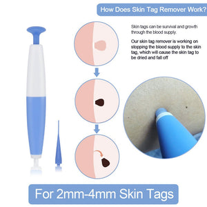 Skin Tag Removal Kit Home Use Mole Wart Remover Micro Band Skin Tag Treatment Tool Easy To Clean Skin Care Tool - Zambeel