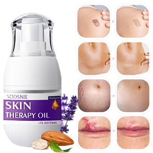 Skin Treatment Oil Remove Puncture Cellulite Stretch Mark Repair Body Care 30ml - Zambeel