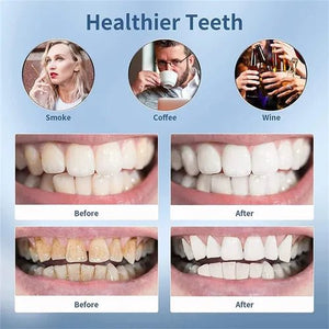 Smart Ultra - Sonic Teeth Cleaner - Zambeel