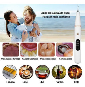 Smart Ultra - Sonic Teeth Cleaner - Zambeel