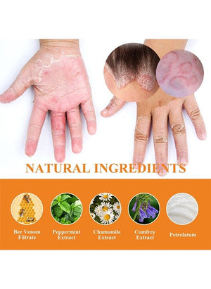 South Moon - Bee Venom Psoriasis Care Cream - Zambeel
