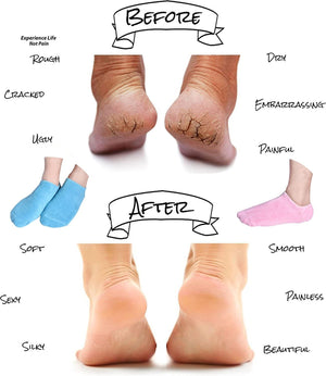Spa Gel Socks Gloves - Zambeel