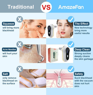 Suction Blackhead Remover Kit Electric Facial Pore Cleanser Acne Cleaner - Zambeel