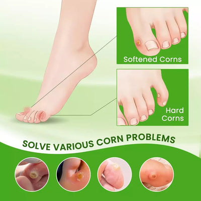 Sumifun - Corns Removal Cream - Zambeel