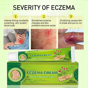Sumifun - Eczema Skin Cream - Zambeel
