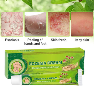 Sumifun - Eczema Skin Cream - Zambeel