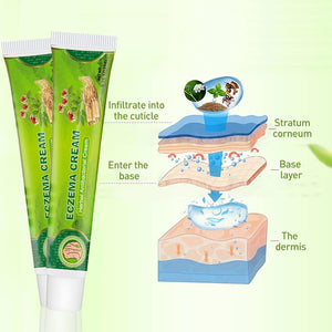 Sumifun - Eczema Skin Cream - Zambeel