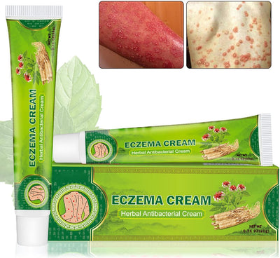 Sumifun - Eczema Skin Cream - Zambeel