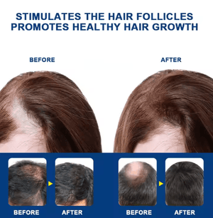 Sumifun - Hair Growth Cream - Zambeel