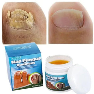 Sumifun - Nail Fungus Ointment (Original) - Zambeel