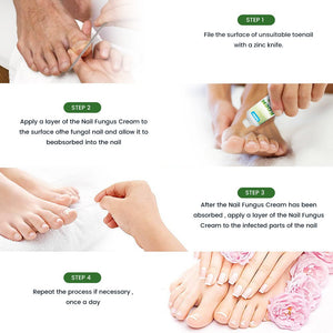 Sumifun - Nail Treatment Repair Gel (Original) - Zambeel